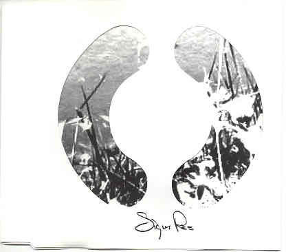 Sigur Ros -